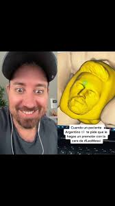 #leomessi esto no puede ser real? #diente #messi #argentina