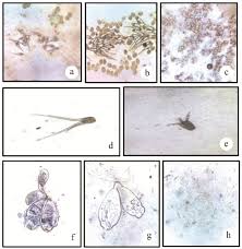 Apr 01, 2018 · paramecium gather in the circle of light which i produced by closing the iris diaphragm on the base of the microscope lamp. Photomicrograph Of Different Protozoan Parasites A H Bengalensis Download Scientific Diagram