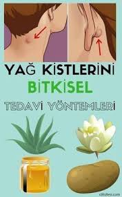 Yag Kisti Bitkisel Tedavi Yontemleri Fitness Tipps Behandlung Zyste
