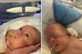 Premature twins born at 22 weeks set to survive