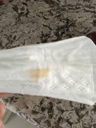 The small swellings will today i have brown mucus discharge. Tan Discharge At 8 Weeks July 2017 Babies Forums What To Expect