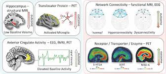 Prognosis And Improved Outcomes In Major Depression A