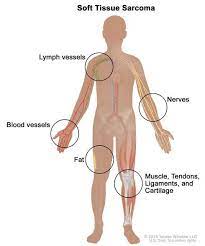 We did not find results for: What Is Cancer National Cancer Institute