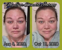 What should I add to my skincare routine for sensitive skin?