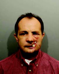 Wilton man who shot himself in face during domestic dispute accepts plea  deal