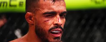 Nick Pace (Peso galo) Perfil do MMA