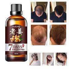 Pin By La Shonda Moore On Herbal In 2021 Hair Care Oil Effective Hair Growth Hair Growth Faster