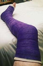 Image result for Short Leg Cast