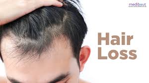 Best hair loss treatment for crown of head: Hair Loss Treatment In India Best Hair Transplant Service Medibout