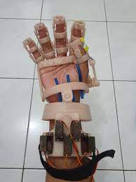 Cara membuat alat bantu dari sarung tangan / tips. Mahasiswa Um Surabaya Bikin Alat Penggerak Jari Bantu Terapi Pasien Stroke