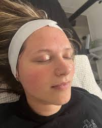 Support group tonight!! Hosted by Rebecca Troain for members of Lancaster  Wellness! Message in Spruce if you want to join tonight in Lebanon for  details!!