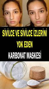 Sivilce Ve Sivilce Izlerini Yok Eden Karbonat Maskesi Evde Nasil Yapilir Sivilce Izi Cilt Bakimi Dogal Akne Tedavisi