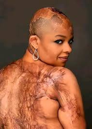 Surviving a House Fire and Finding Gratitude