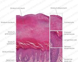 Histology Skin Layers 2