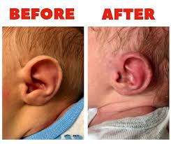 Pin On Before After