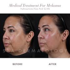 SBA Dermatology & Plastic Surgery