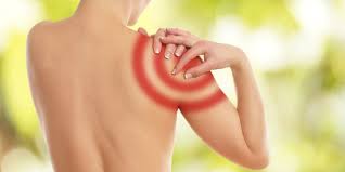 Prellung Der Schulter