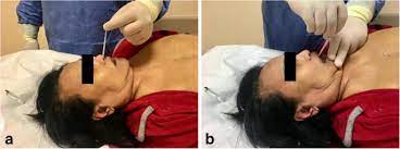 autopsy practised in modern china. A Technical Report From The Italian Sars Cov 2 Outbreak Postmortem Sampling And Autopsy Investigation In Cases Of Suspected Or Probable Covid 19 Springerlink