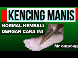 Selain mampu mengurangi resiko penyakit, mengonsumsi sayuran juge bermanfaat untuk kesehatan lainnya. Cara Menormalkan Sakit Kencing Manis Diabetes Hanya Dengan Pijat Refleksi Youtube