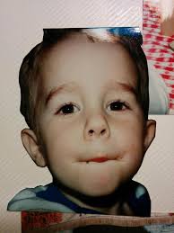 Open heart surgery this week, bigger gains more giggles and some carbon  happening 💪