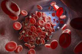 Image result for Anticoagulation