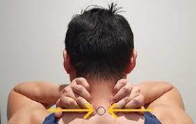 After the incision, the bony, rigid area at the back of the neck known as lamina is removed. How To Get Rid Of A Dowager S Hump Posture Direct