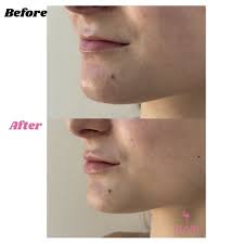 Michael Frederick (@dr.mikelespa) • Instagram photos and videos