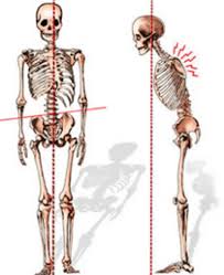 Notes on anatomy and physiology: Back And Spine Complete Pain Care Helping You Return To You