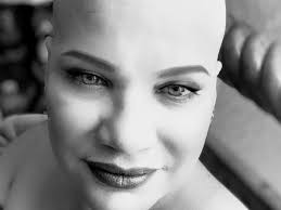 Fundraiser by Alexandria Ward : Wanda's Urgent Surgery