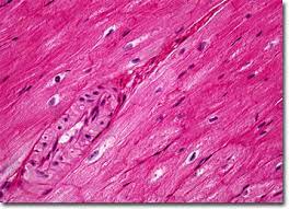 As indicated by its name, the tissue displays no striations or other distinct patterns under the microscope. Molecular Expressions Microscopy Primer Anatomy Of The Microscope Brightfield Microscopy Digital Image Gallery Mammalian Smooth Muscle Tissue