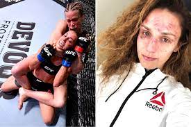 Antonina shevchenko, with official sherdog mixed martial arts stats, photos, videos, and more for the. Antonina Shevchenko Shows Off Brutal Damage From Katlyn Chookagian Ufc Fight