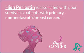 What is metastatic breast cancer (also known as stage 4 breast cancer), and what are its the symptoms may vary, depending on how far your breast cancer has spread and what type of tissue other nonspecific systemic symptoms of metastatic breast cancer can include fatigue, weight loss. Periostin Is Associated With Poor Survival In Breast Cancer Biomedica