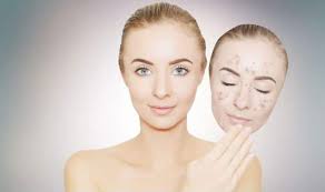 Scrubbing is beneficial as it helps to remove dead cells and. Want To Get Rid Of Dark Spots These Home Remedies May Help