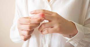 Fingerschmerzen Ursache Behandlung Und Ubungen Liebscher Bracht