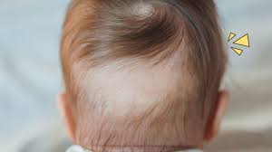 Rambut tumbuh dari kantong kecil kulit kita yang disebut sebagai folikel. Rambut Bayi Rontok Kenali Penyebab Dan Cara Mengatasinya Orami