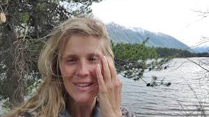 2 years ago, I was in recovery at Alone Season 8 HISTORY. This picture  popped up in my memories today; I had yet to access any social media or see  any updated