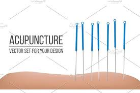 Acupuncture Therapy Spa Treatments Spa Treatments Acupuncture Therapy
