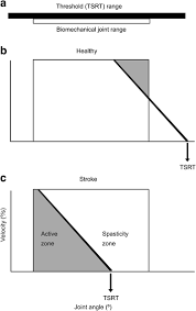 Personalized Upper Limb Training Combined With Anodal Tdcs