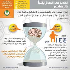 الحديد والزهايمر Decor Home Decor