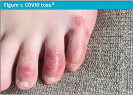 Accordingly, these clinical pathways are not intended to constitute medical advice or treatment, or to create a. Multisystem Inflammatory Syndrome In Children Mis C Who Should Not Be Misc Ed Journal Of Urgent Care Medicine