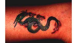 Tattoo Allergy Rash And Other Reactions To Ink Treatment More