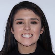 Invisible Braces vs Invisalign