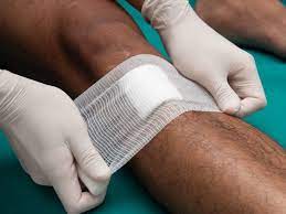 Don't place soap in the wound. Open Wound Care Types Risks And Treatment