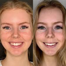 Dani Roberts, ARNP, CANS