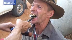 Outback dentist removes teeth with pilers and wooden bat