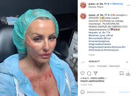 51,455 likes · 2,138 talking about this. Dagmara Kazmierska Z Krolowych Zycia Pokazala Twarz Cala We Krwi Co Sie Stalo