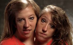 Born conjoined, the twins might have been separated at. Abby And Brittany Hensel Restroom Dicephalic Conjoined Twins Spicytec Abby And Brittany Hensel Restroom German Valez