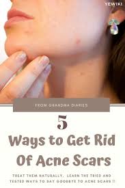 Pin On Diy Organic Beauty