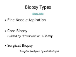 A special type of excisional biopsy of the breast is the needle localization biopsy, also called the. Fine Needle Aspiration Biopsy By Dr Tarek Atia Ppt Download