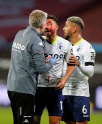 ملخص لمسات تريزيجيه أمام فولهام. ØªØ±ÙŠØ²ÙŠØ¬ÙŠÙ‡ ÙŠØªØ¹Ø±Ø¶ Ù„Ø¥ØµØ§Ø¨Ø© Ù‚ÙˆÙŠØ© ÙÙ‰ Ø§Ù„ÙˆØ¬Ù‡ Ø®Ù„Ø§Ù„ Ù…ÙˆØ§Ø¬Ù‡Ø© ÙˆØ³Øª Ù‡Ø§Ù… ÙˆØ£Ø³ØªÙˆÙ† ÙÙŠÙ„Ø§ ØµÙˆØ± Ø§Ù„ÙŠÙˆÙ… Ø§Ù„Ø³Ø§Ø¨Ø¹